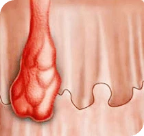 Noduli
